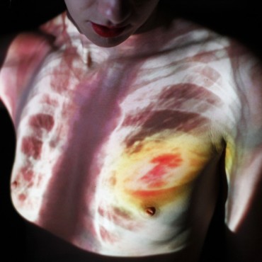 Tumor: karcinogenní romance